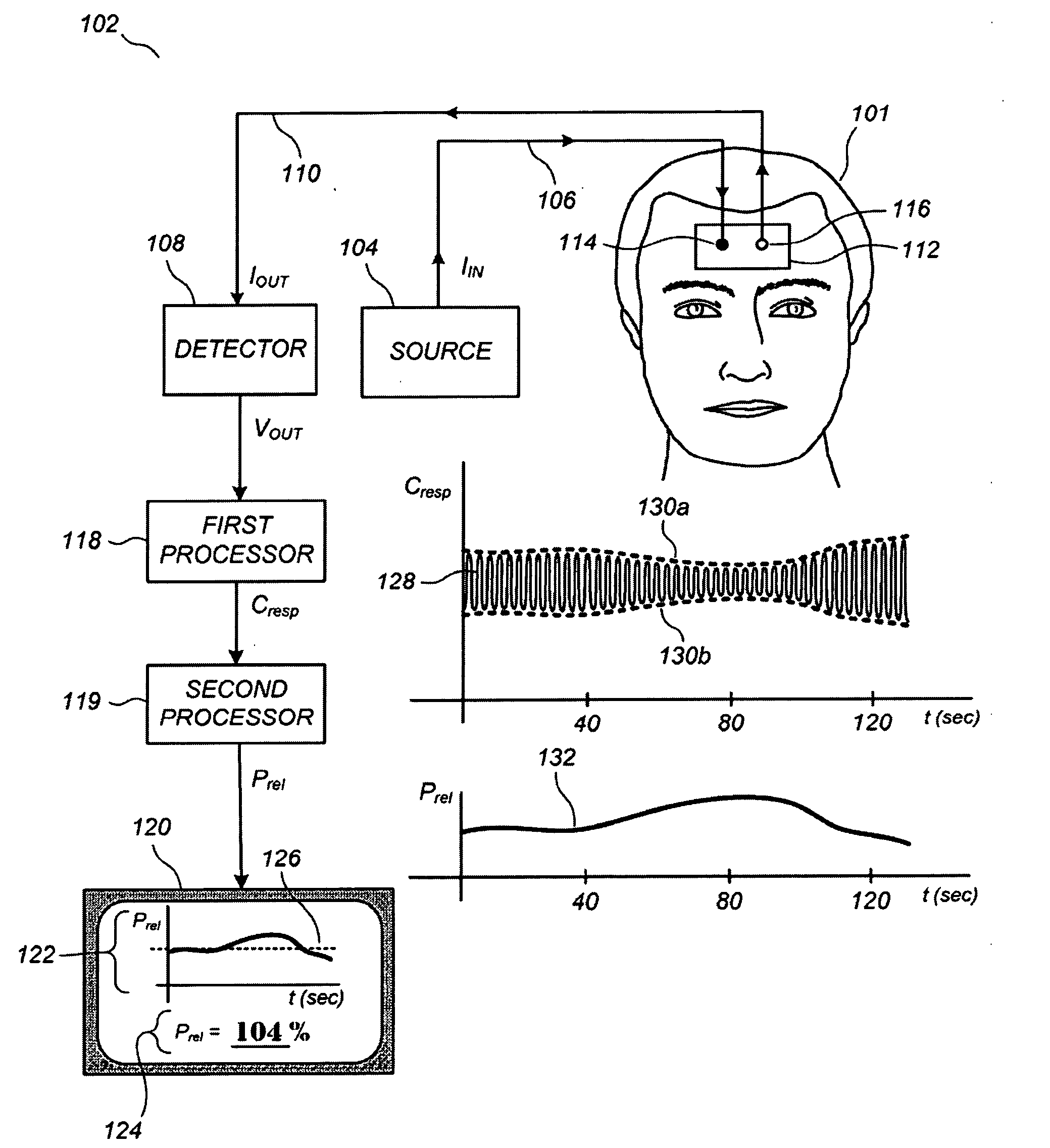 Non-invasive monitoring of intracranial pressure