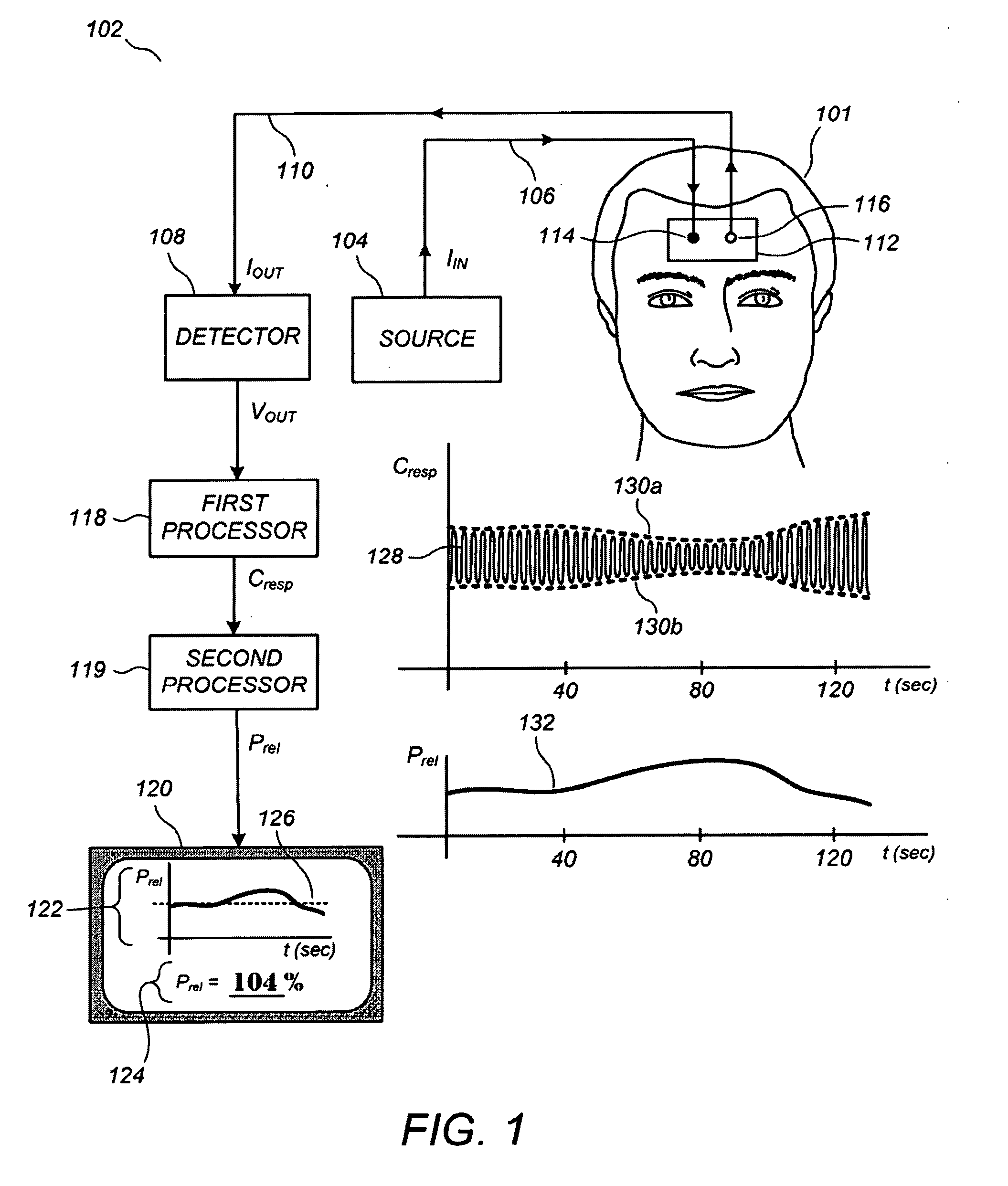 Non-invasive monitoring of intracranial pressure