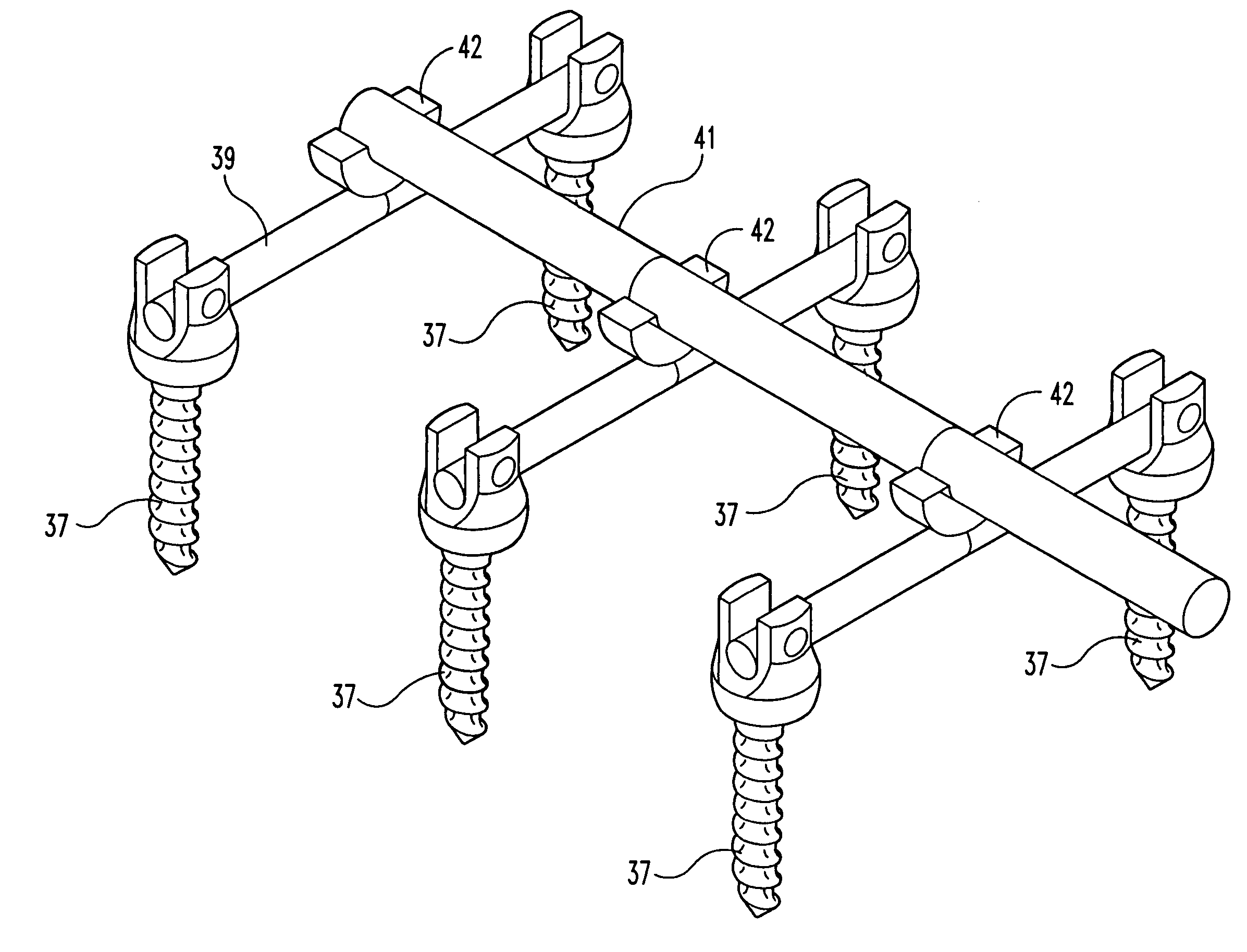 Spinal fixation system and related methods