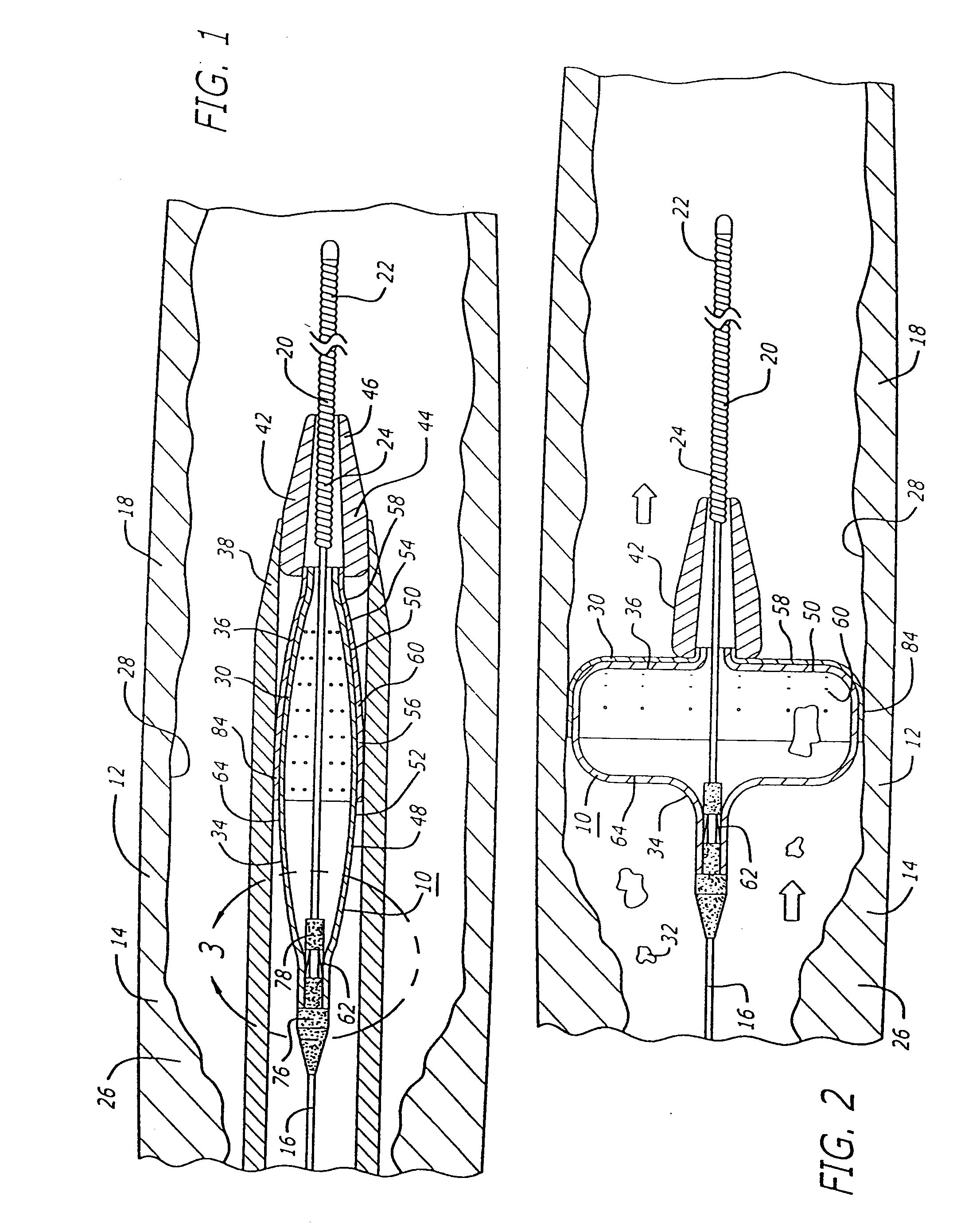 Filter device for embolic protection systems