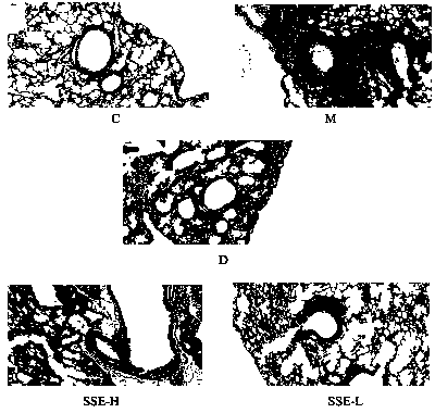 Application of shuteria root total flavonoid extract