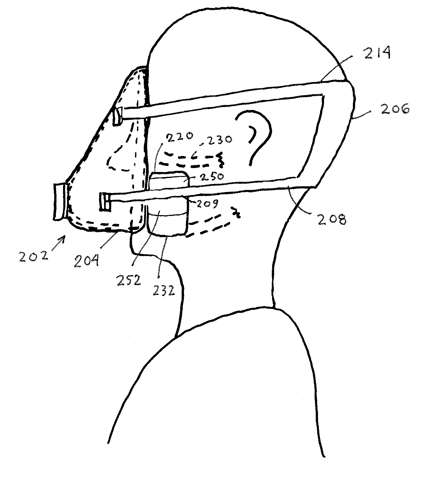 Cheek depressors and method of use