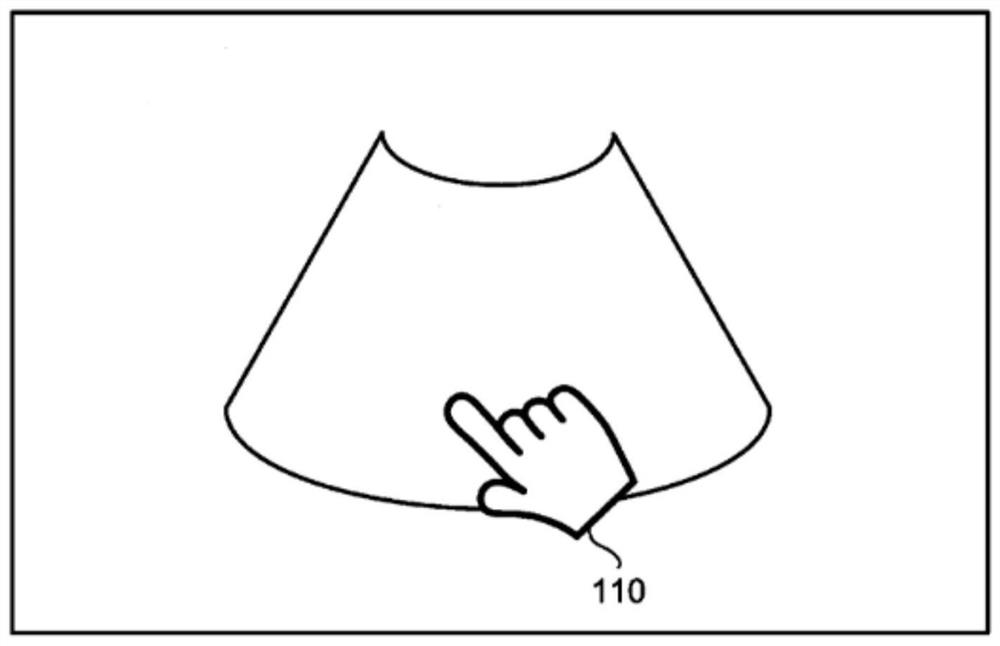 Ultrasonic image annotation method, storage medium and ultrasonic equipment