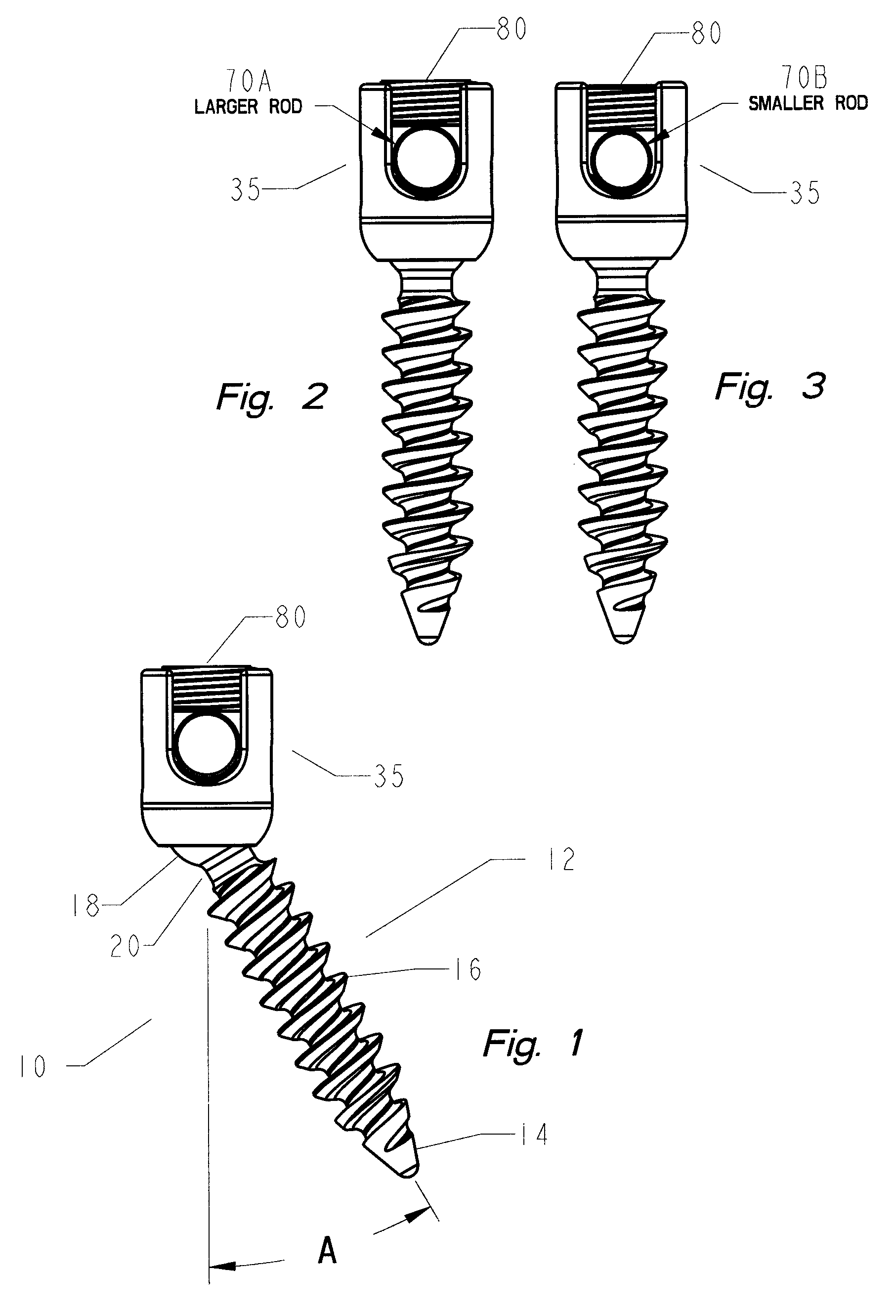 Thread-thru polyaxial pedicle screw system