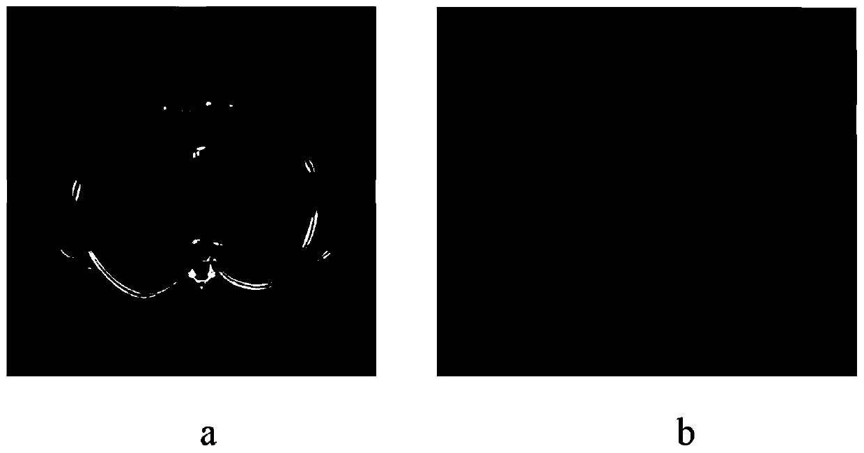 Enhanced low-rank sparse decomposition model medical CT image denoising method