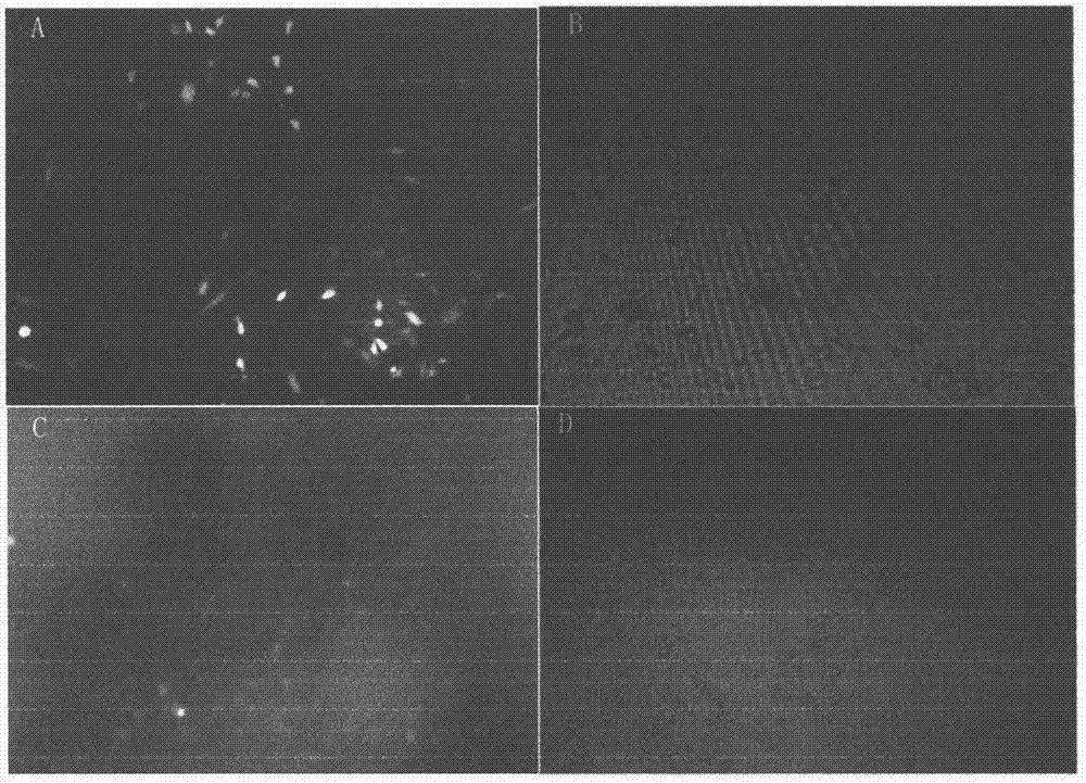 Bone marrow derived mesenchymal stem cell line for stable expression of exogenous EX-4 gene