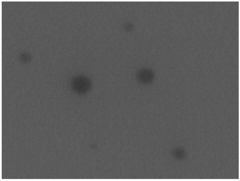 Tripterygium glycosides nano-emulsion gel and preparation method thereof