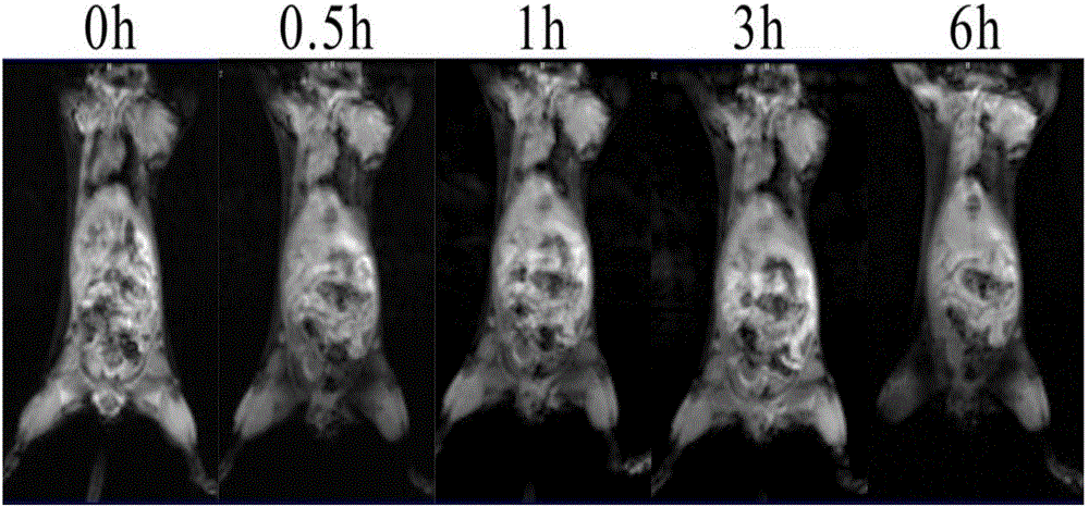 MRI and PTT diagnosis and treatment integration functional microsphere with core-shell structure and preparation method thereof