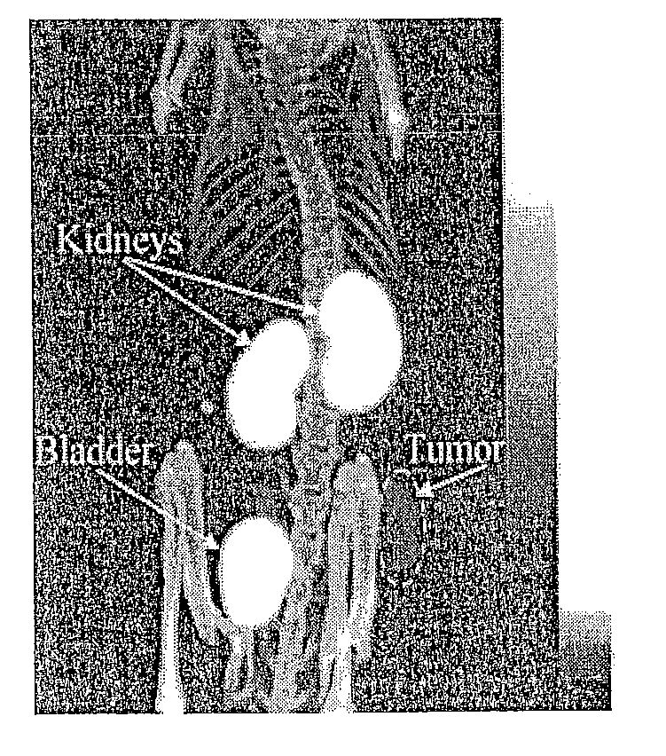 Arg-gly-asp-conjugated alpha-melanocyte stimulating hormone hybrid peptide for use in diagnosing and treating melanoma, including metastatic melanoma and methods related to same