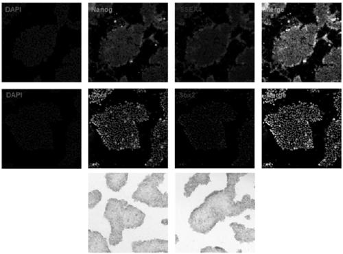 Method for establishing human arrhythmogenic right ventricular cardiomyopathy (ARVC) disease model