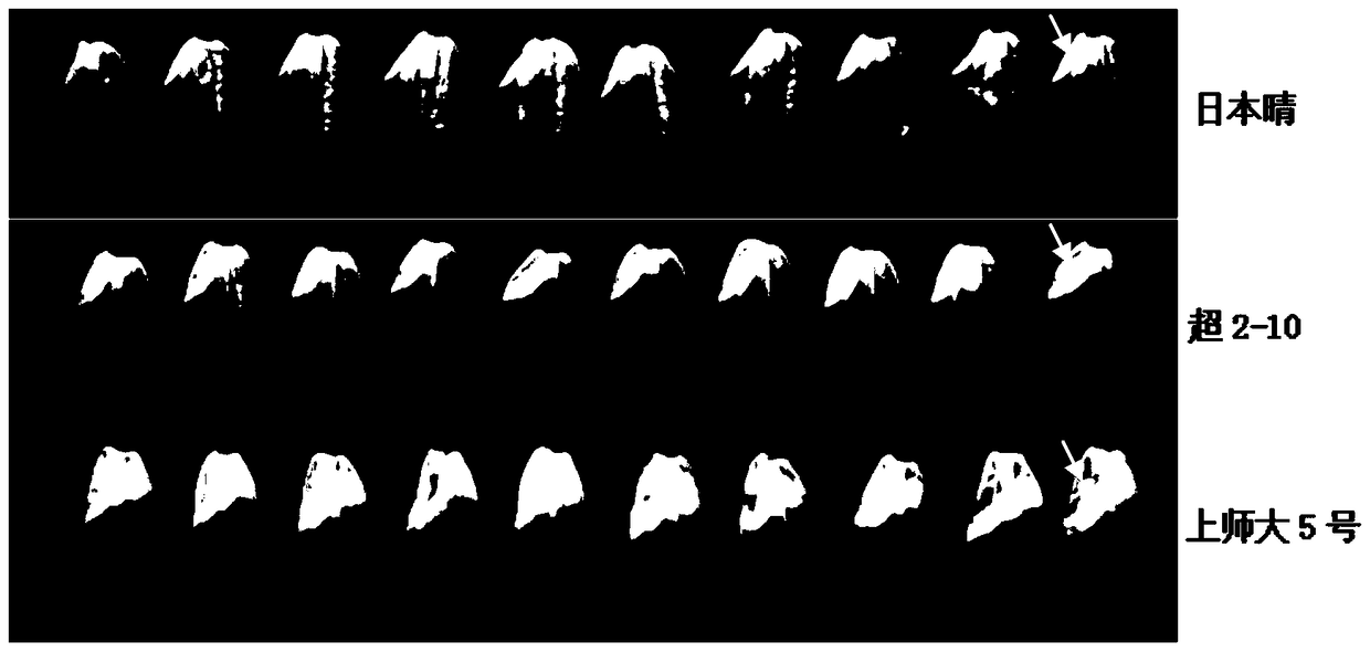 A gene sequence and its application