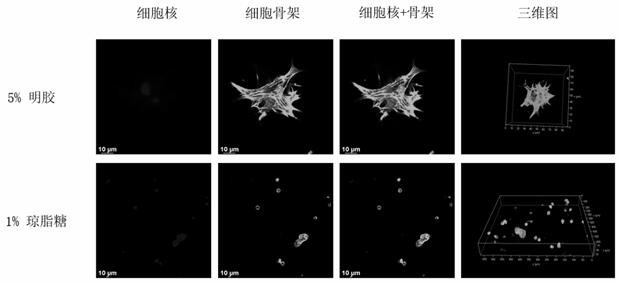 Personalized 3D printing meniscus regeneration stent and preparation method thereof