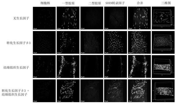 Personalized 3D printing meniscus regeneration stent and preparation method thereof