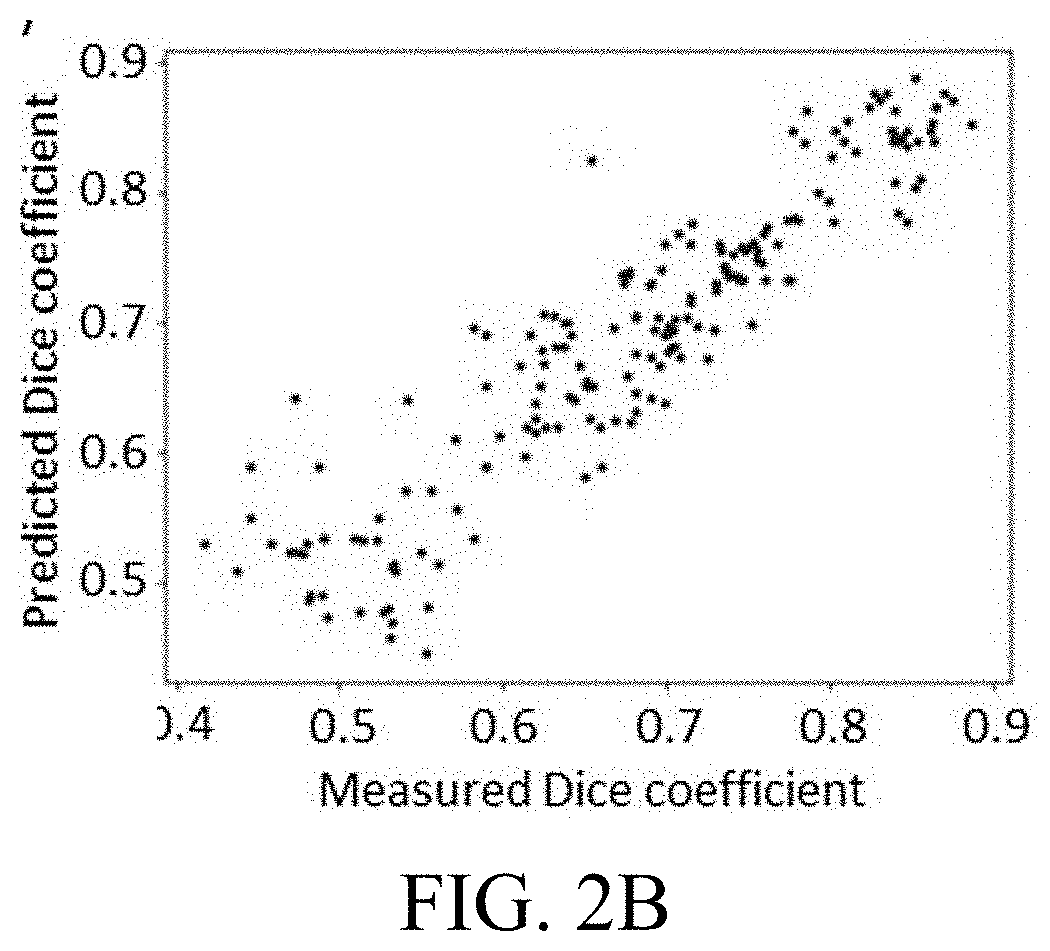 Evaluating Quality of Segmentation of an Image into Different Types of Tissue for Planning Treatment Using Tumor Treating Fields (TTFields)