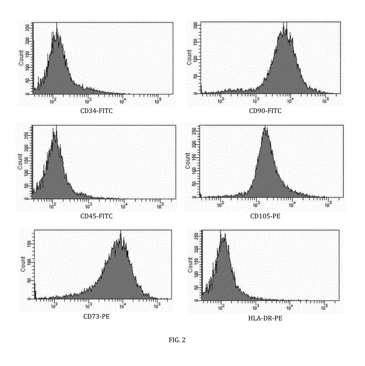 Cell-based composition and use thereof for treatment of macular oedema and degeneration