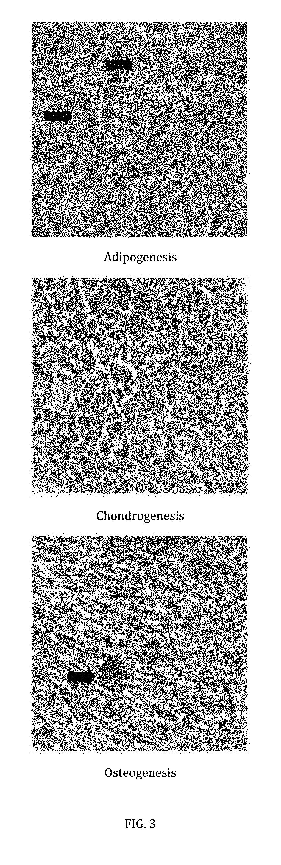 Cell-based composition and use thereof for treatment of macular oedema and degeneration