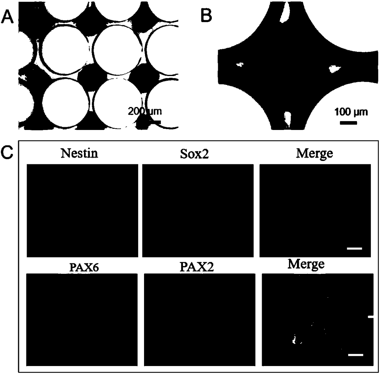 Microarray chip preparation method, and applications of microarray chip in stem cell type brain development