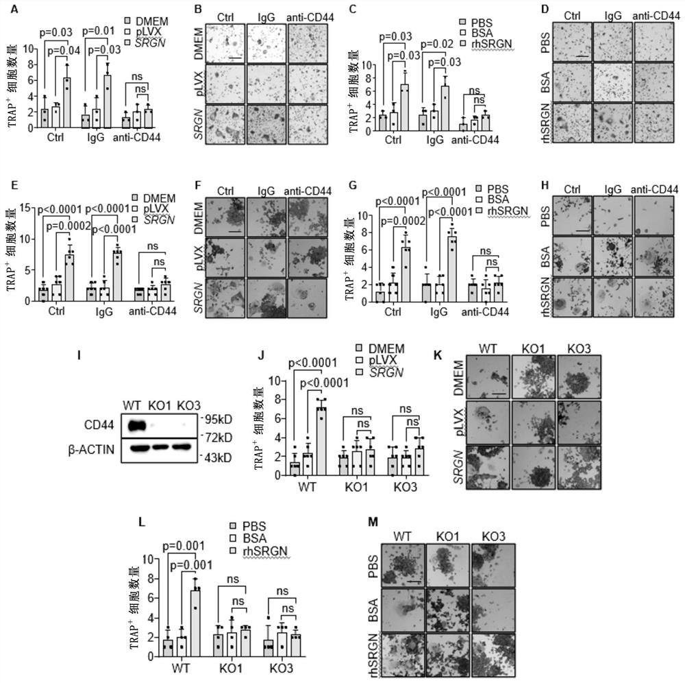 Method for treating giant cell tumor of bone