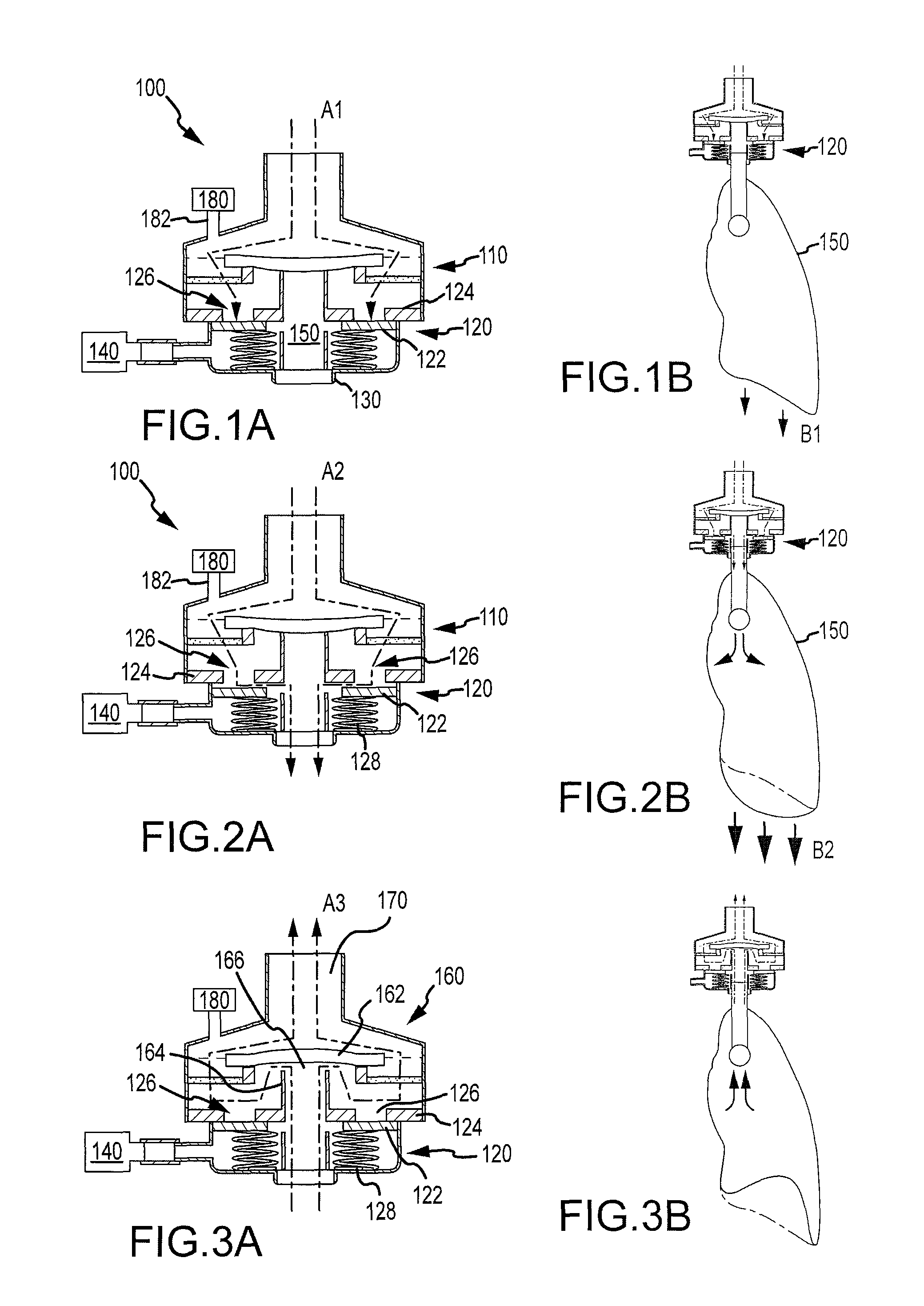 Method and system to decrease intracranial pressure, enhance circulation, and encourage spontaneous respiration