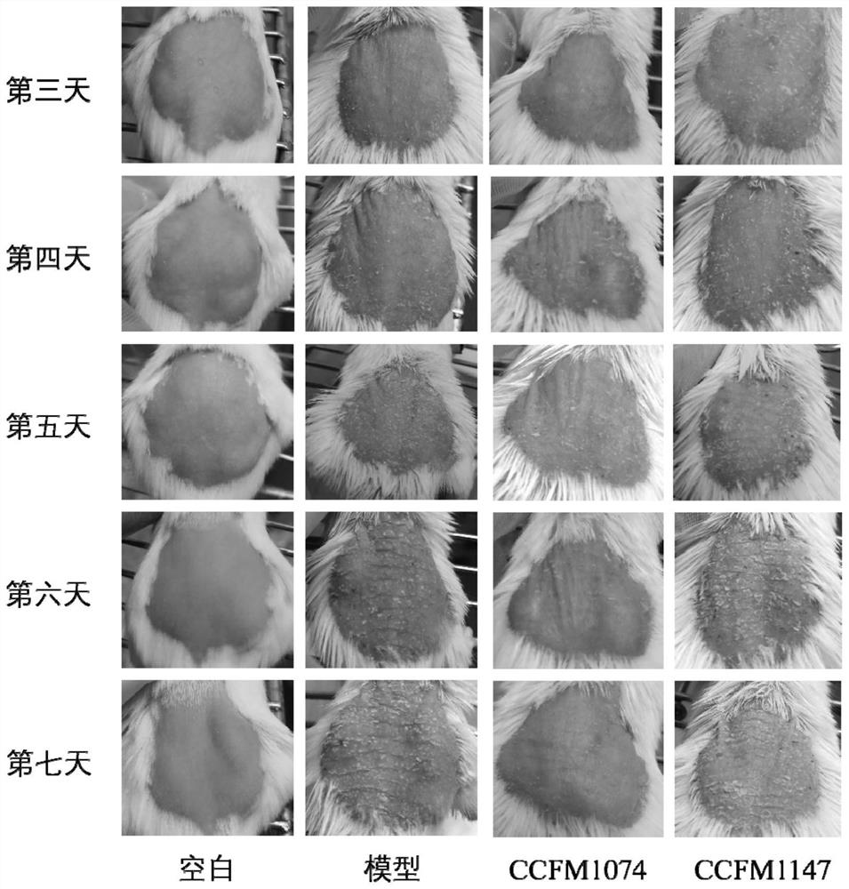 Lactobacillus casei for improving pathological characteristics of psoriasis-like mice and application of lactobacillus casei