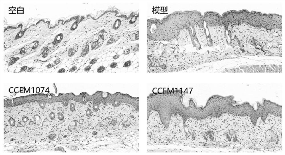 Lactobacillus casei for improving pathological characteristics of psoriasis-like mice and application of lactobacillus casei