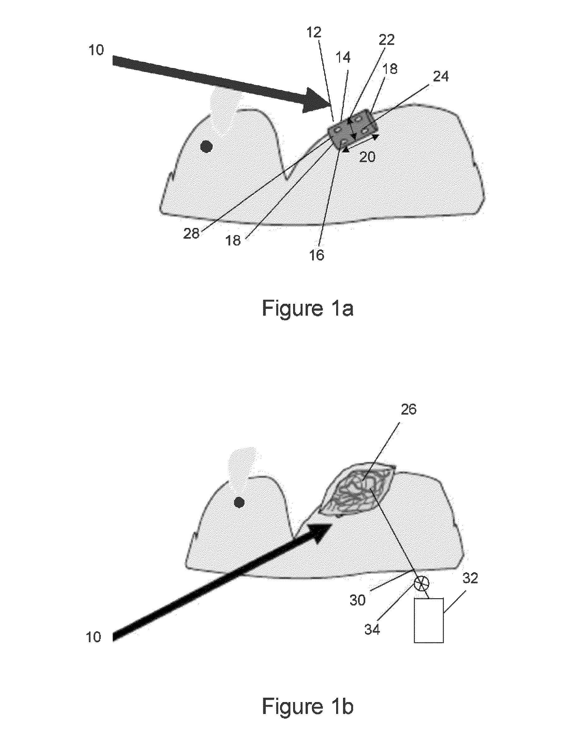 Apparatus and Process for Generating and Harvesting Adult Stem Cells and Fluid Associated with it from Skin and Omentum for Medical, Cosmetic, and Veterinary Use