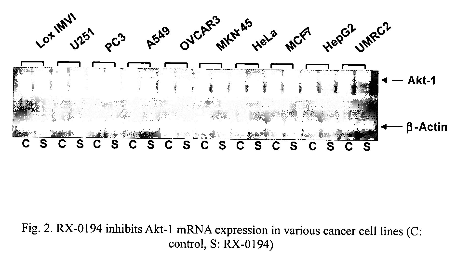 Use of antisense oligonucleotides to inhibit the expression of human Akt-1