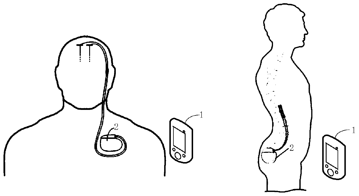 Implantable neurostimulation device with frequency conversion function and system