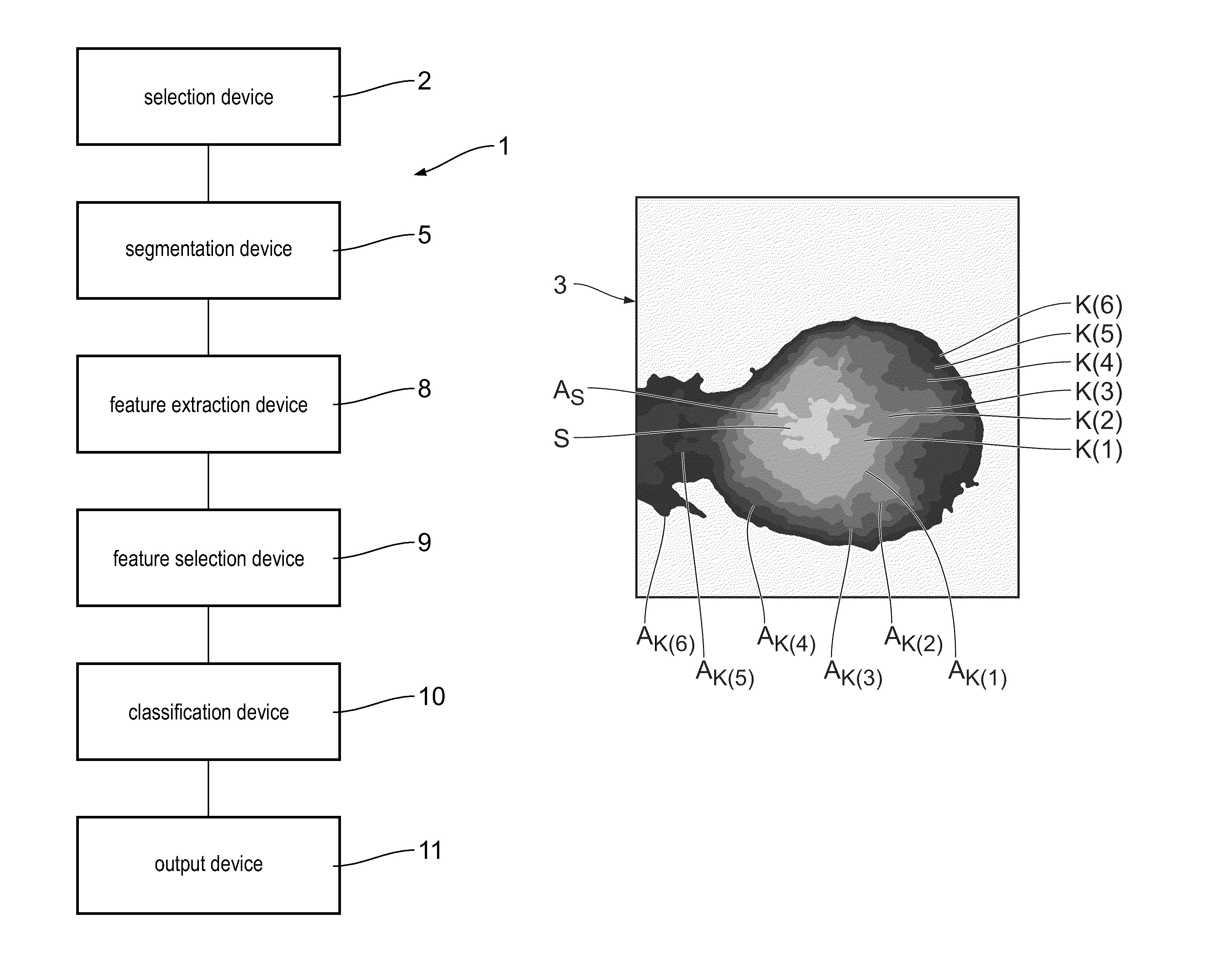 Method and device for the segmentation of a lesion