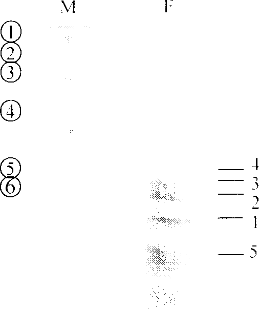 Method for amplifying NSCs and inhibiting it to neuroglial cell differentiation and its use