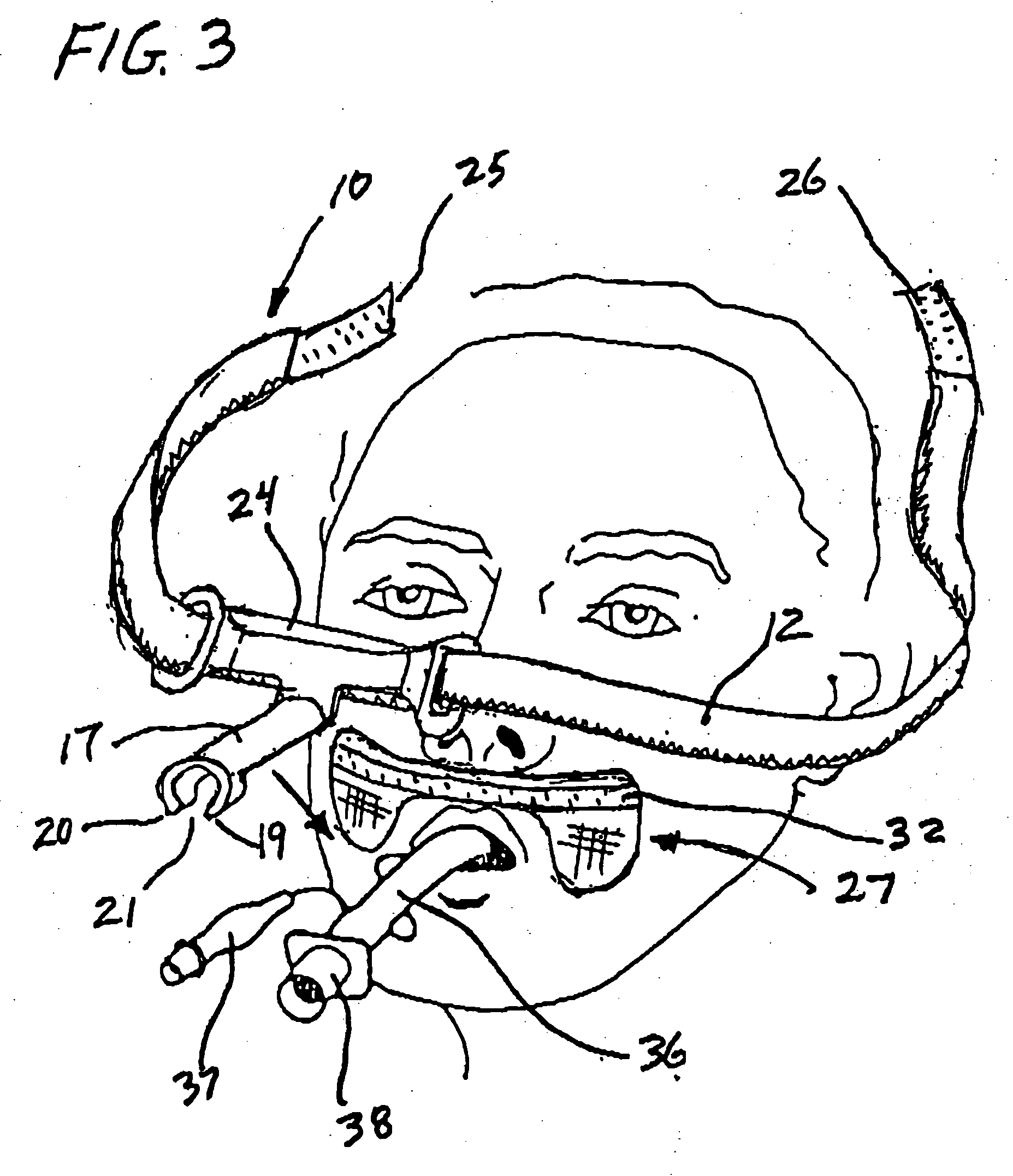 Endotracheal tube holder