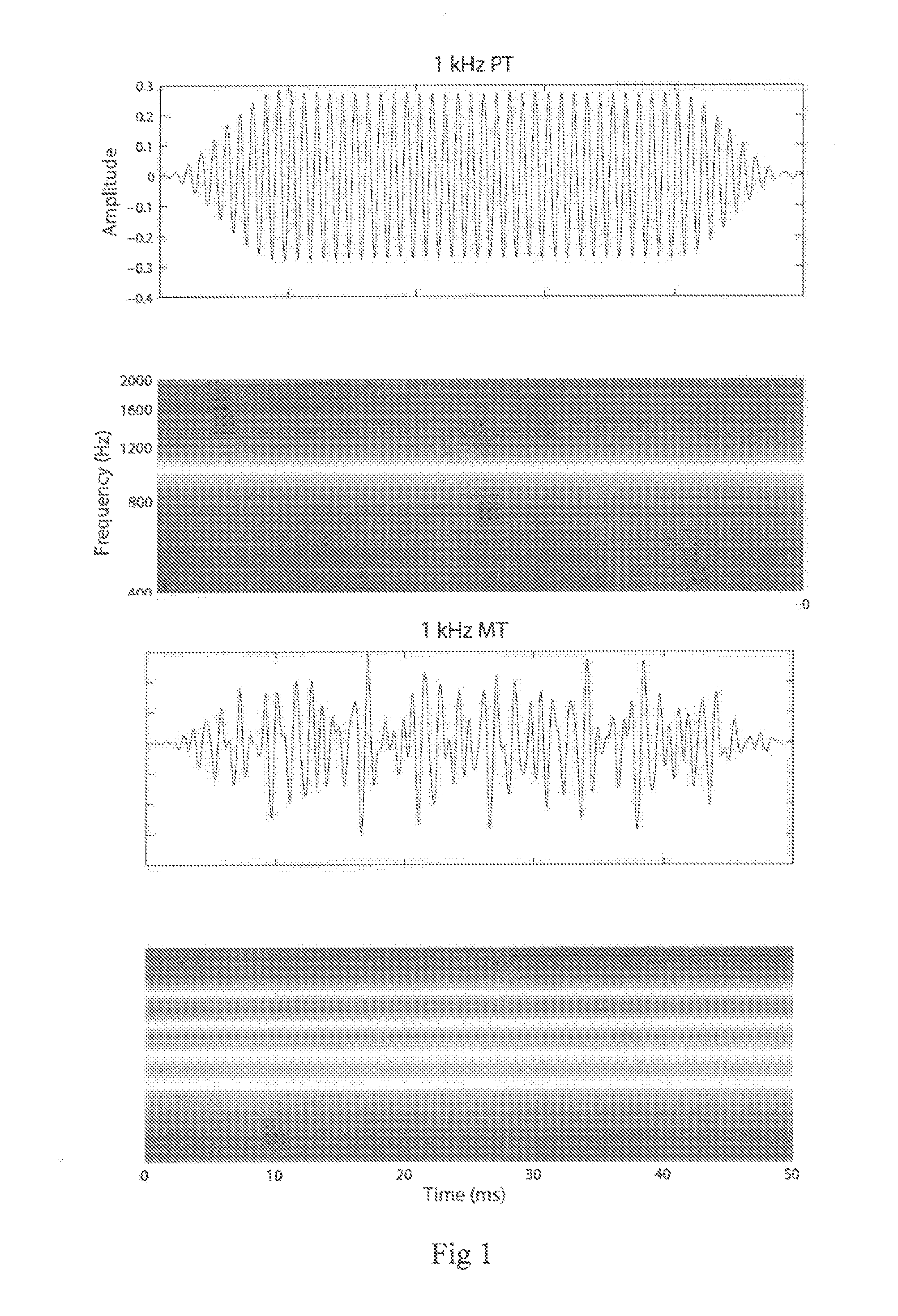 Systems and methods for objectively determining hearing thresholds