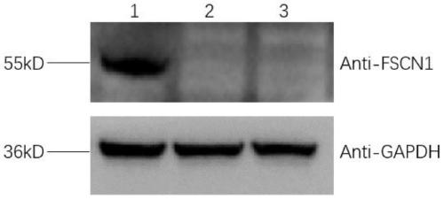 Method for constructing FSCN1 gene stable knockout cell line, plasmid or plasmid combination and application thereof