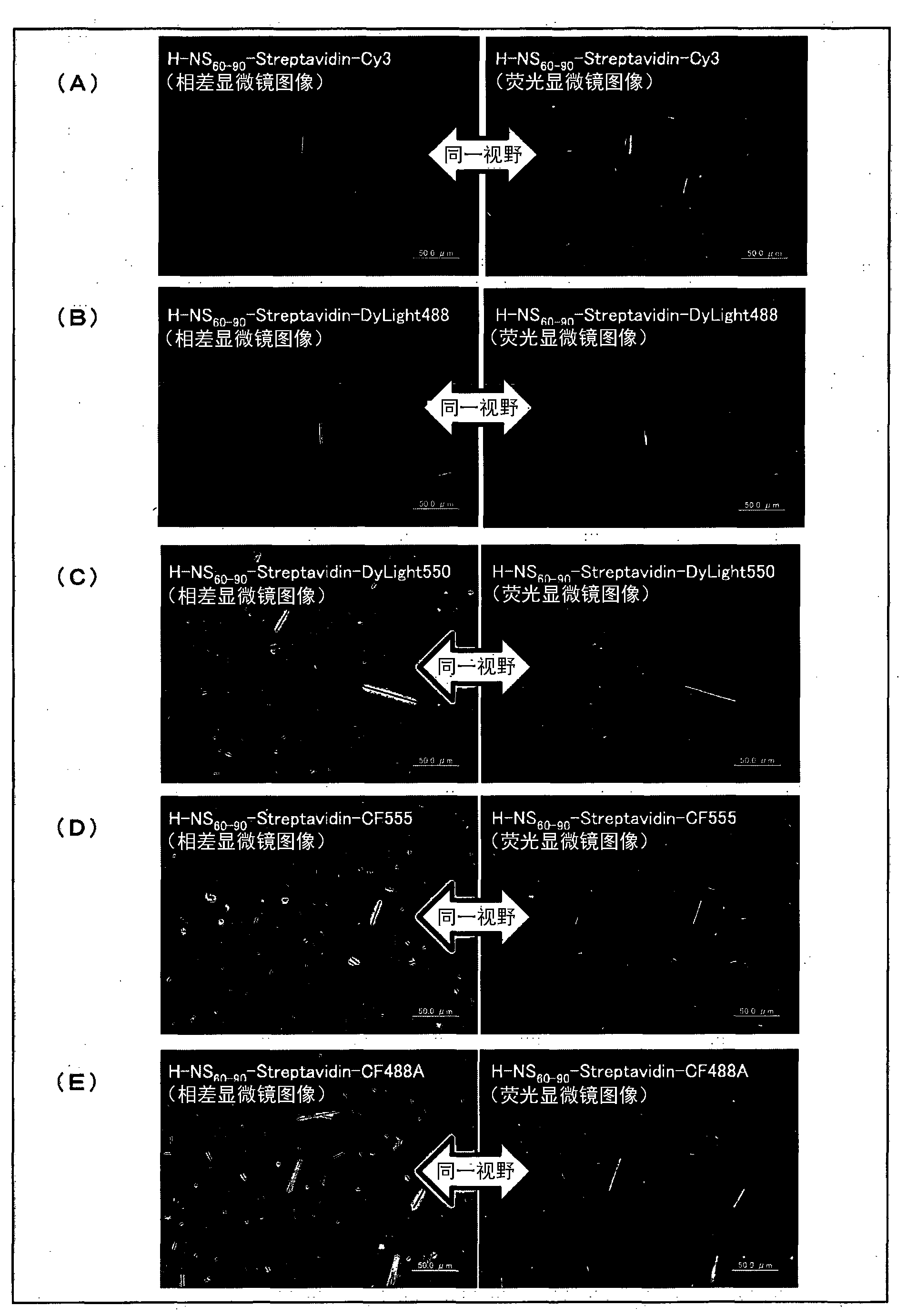 Method for detecting asbestos