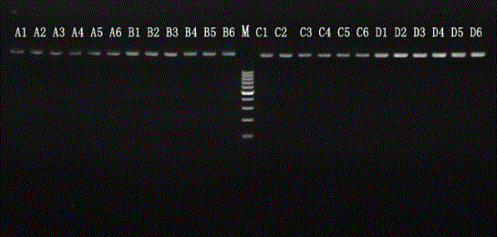 Kit for rapidly extracting nucleic acid in amniotic fluid and chorionic tissue sample