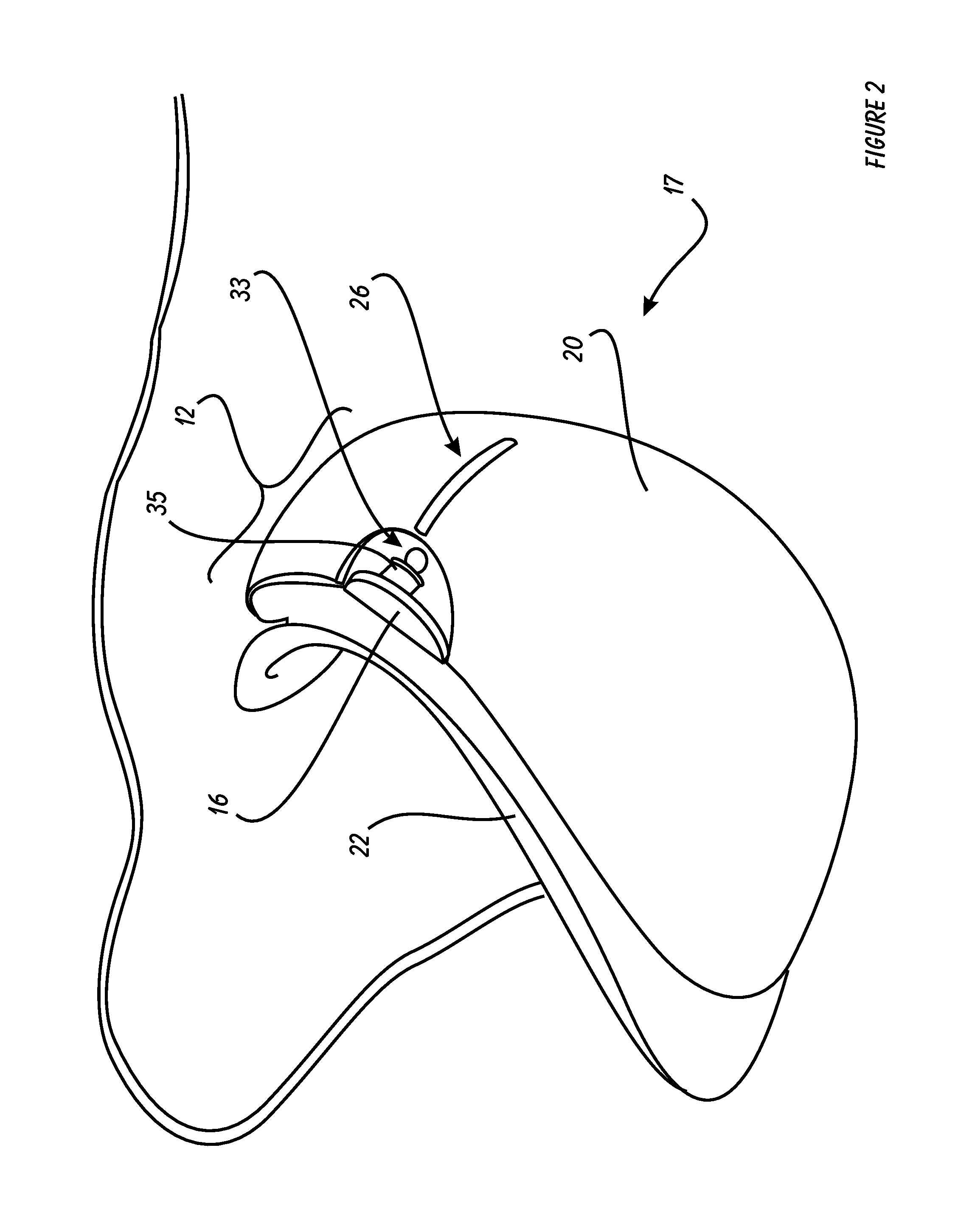 Personal Care Vaporizer Device for the Eye Area of the Face