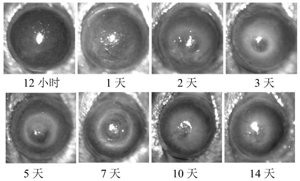 Application of C-type lectin-like receptor-1 as therapeutic marker of fungal keratitis