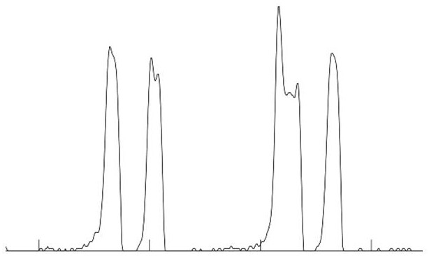 A kind of blood cell pulse counting error correction method and correction device