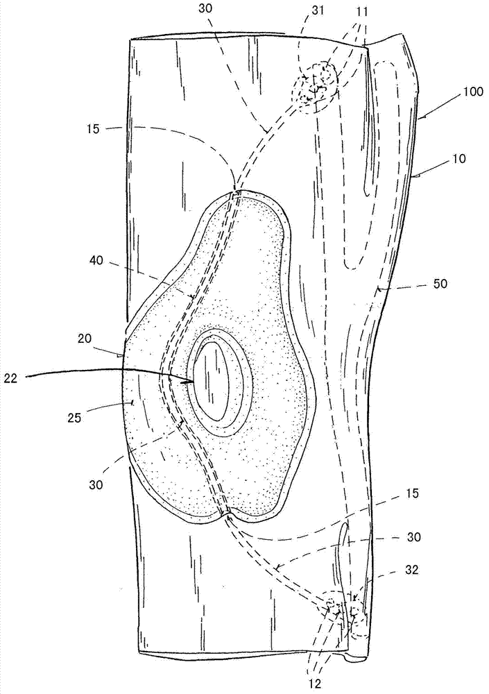 Improved knee bandage having a corrective strap