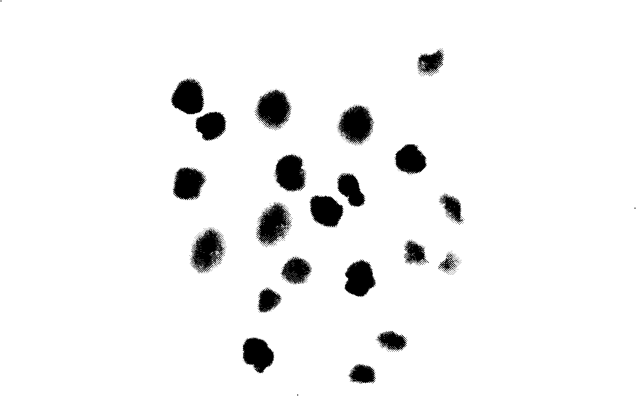 Preparation of docetaxel long-circulating liposome and freeze-dried powder injection thereof