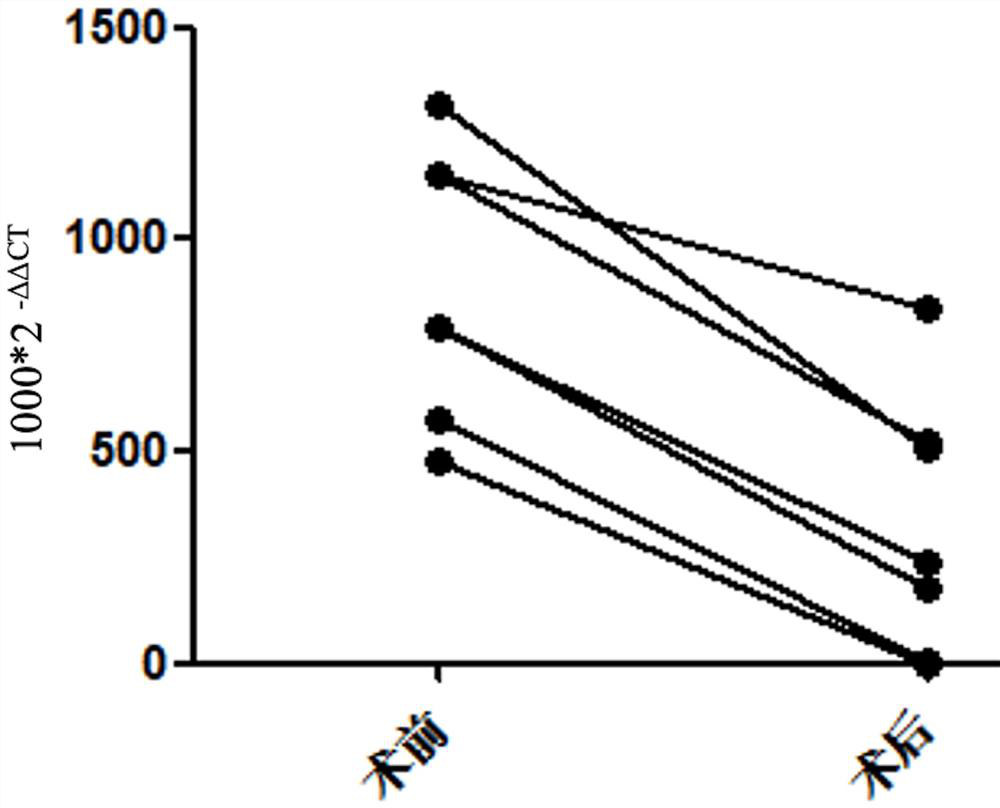 Application of exosome mRNA in breast disease diagnosis