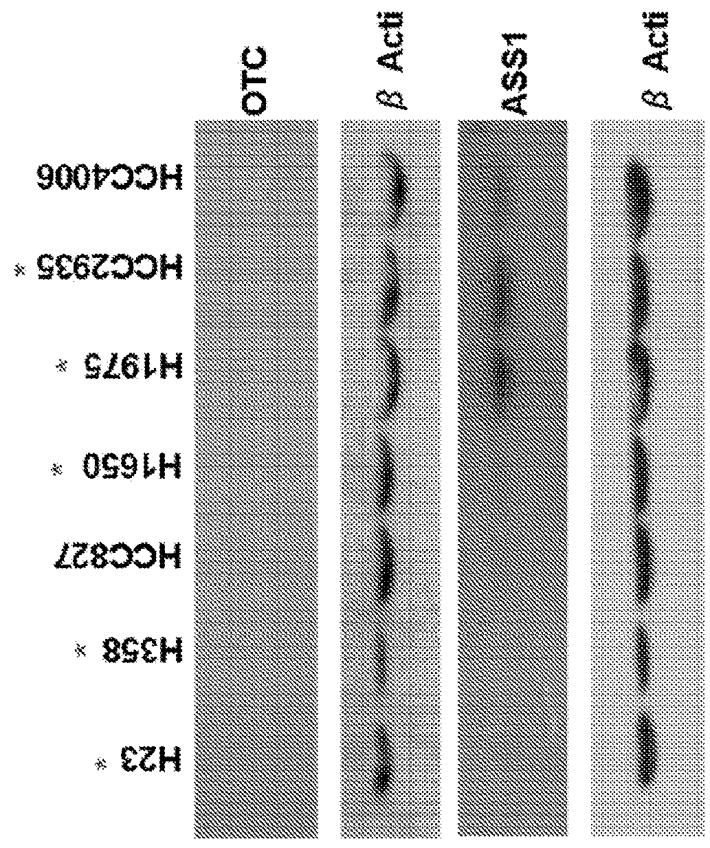 Method to treat cancer using arginine delpetor and ornithine decarboxylase (ODC) inhibitor