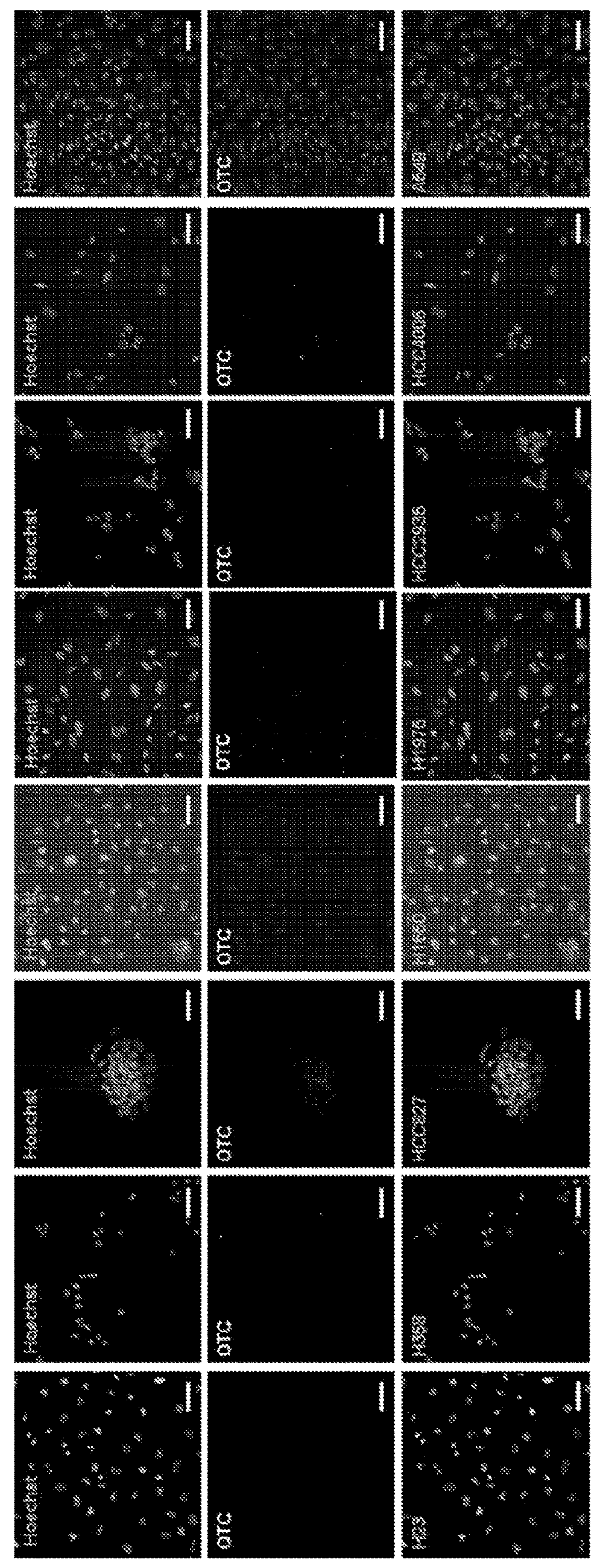 Method to treat cancer using arginine delpetor and ornithine decarboxylase (ODC) inhibitor