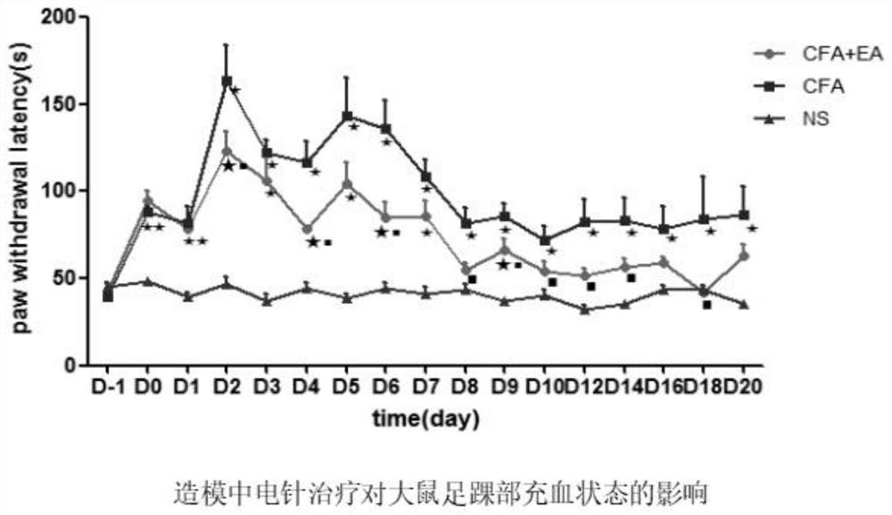 Acupuncture serum exosome as well as preparation method and application thereof