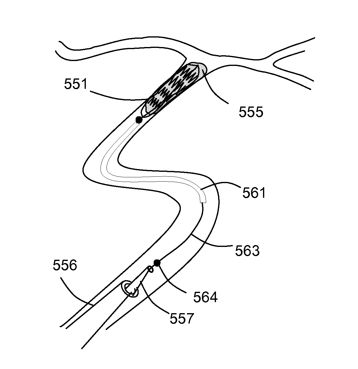 A clot removal device