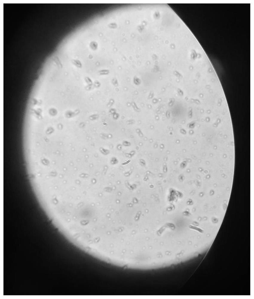 Efficient potassium-dissolving nitrogen-fixing bacterium and application thereof