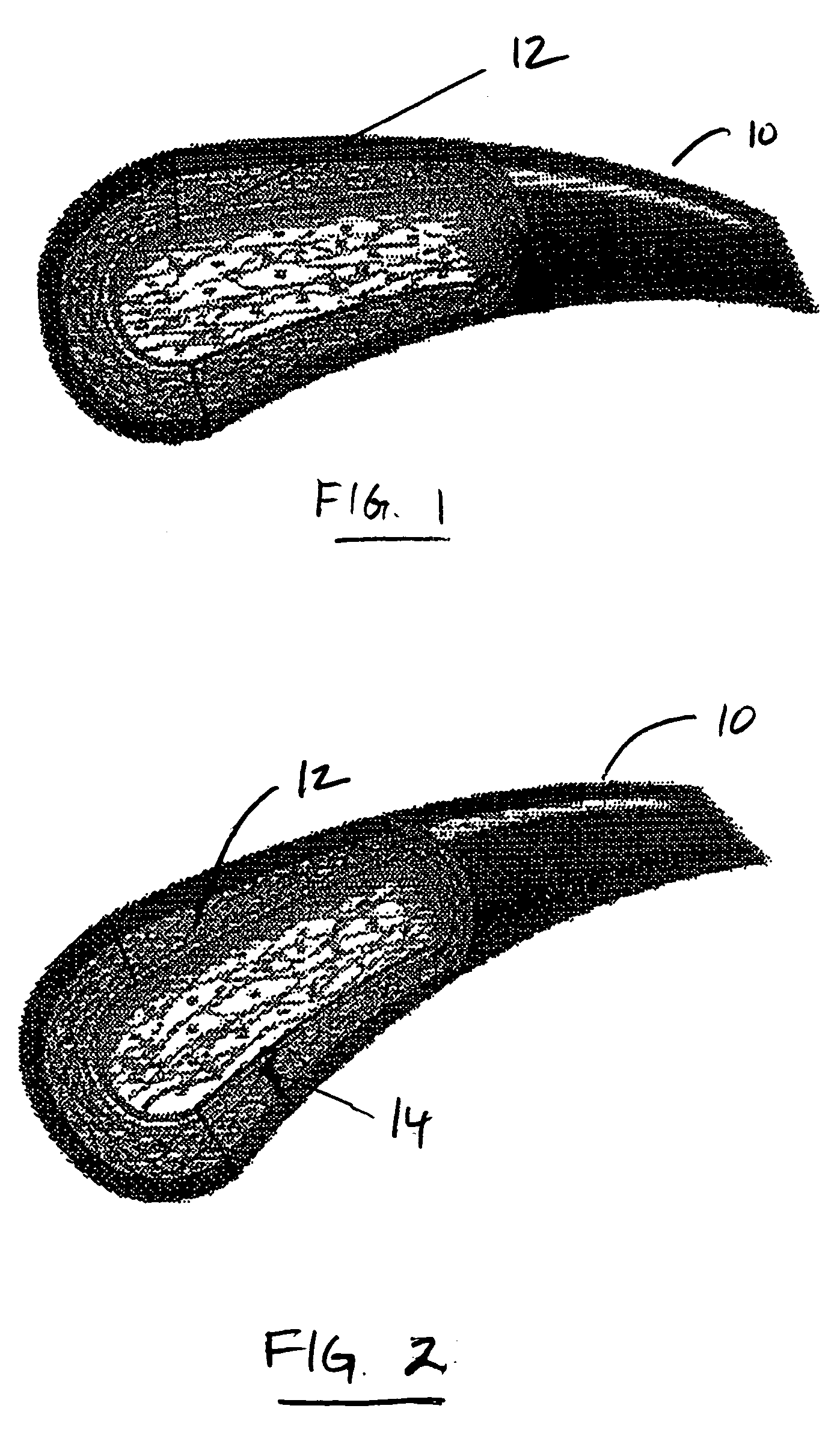 Apparatus and method for non-invasive diagnosing of coronary artery disease