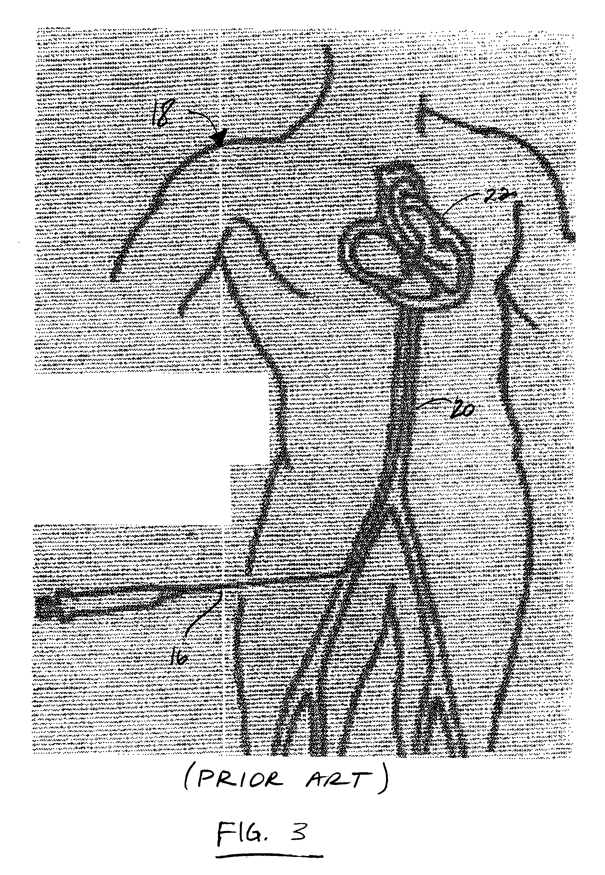 Apparatus and method for non-invasive diagnosing of coronary artery disease