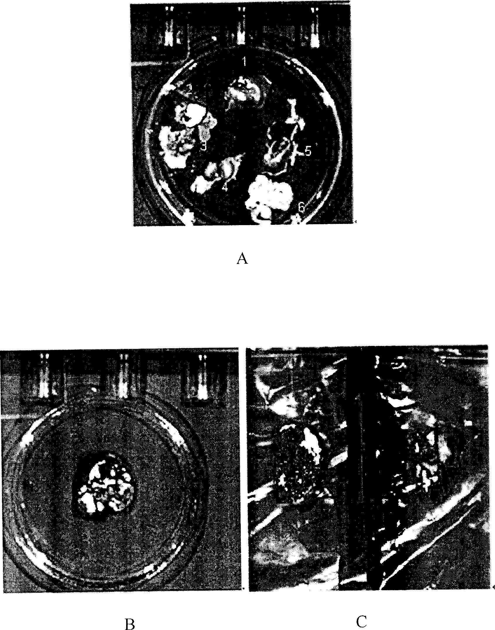 Application of expression TRAIL protein colon bacillus for preparing medicine to treat tumor