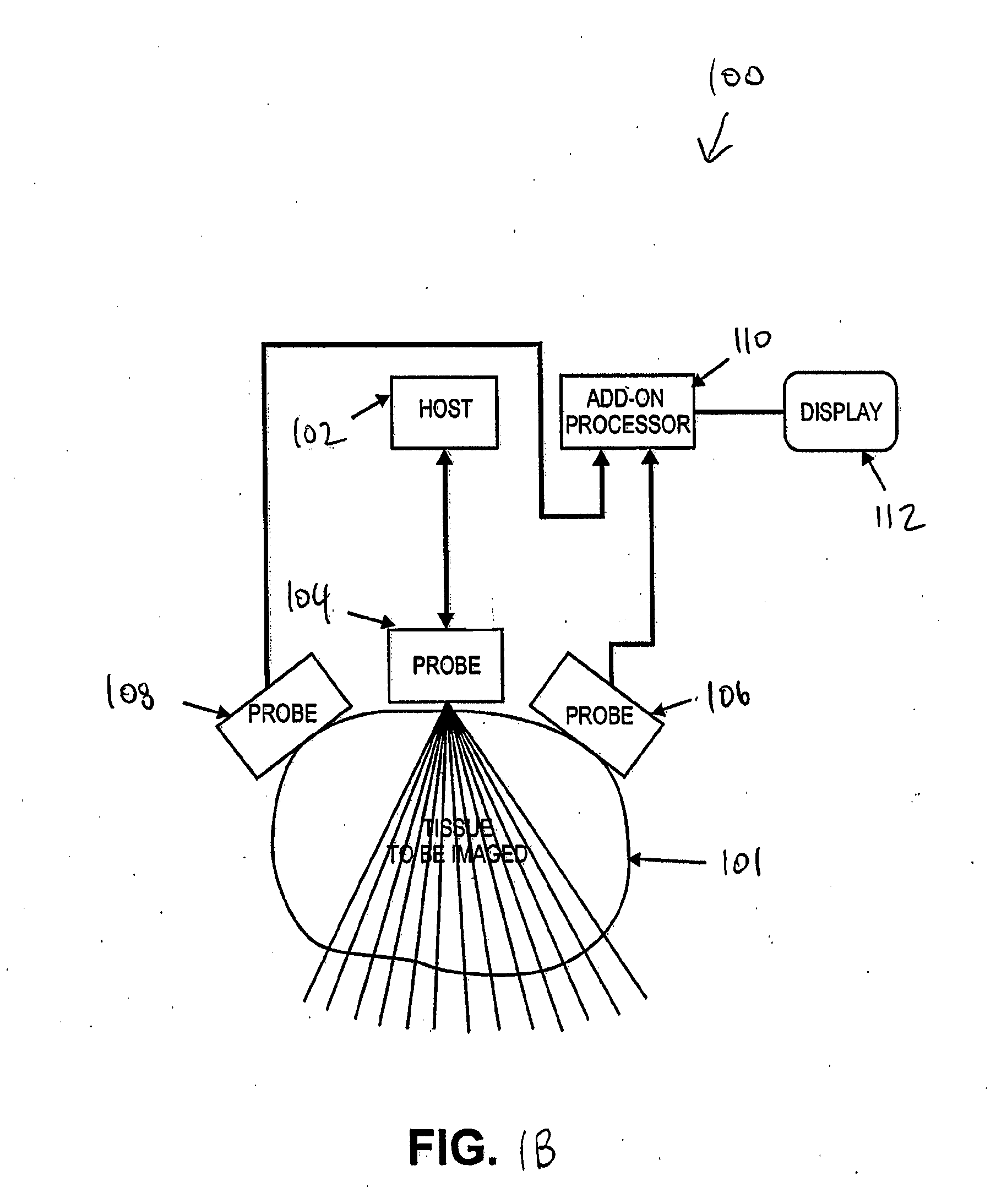 Imaging with multiple aperture medical ultrasound and synchronization of add-on systems